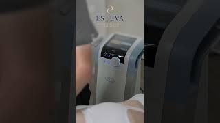 Exilis Ultra 360 - reducerea țesutului adipos prin radiofrecvență @estevainstitute