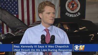 No, That Wasn't Drool On His Lips, Rep. Joe Kennedy Says