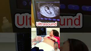 Ultrasound / Sonography                    #pregnancy #ultrasound #sonography #baby #babyshorts