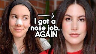 I Got (Another) Nose Job  | My Revision Rhinoplasty Journey & Recovery Vlog