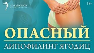 Липофилинг ягодиц. Осложнения. Как избежать? / 18+