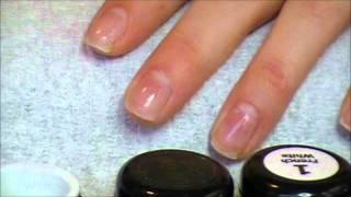 Gel Gadation Technique And Tutorial