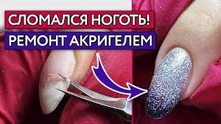 Как исправить сломанный ноготь? / Ремонт ногтя акригелем