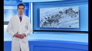 Dr. Weigert tutorial - specific prevention of chloride-induced pitting corrosion