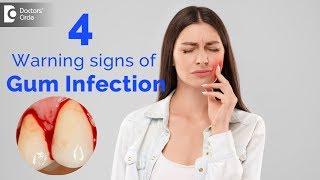 Why do my gums bleed? | Warning signs of Gum Infection - Dr. Rizwana Tarannum | Doctors' Circle