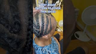 Best BRAID PATTERN to Cover THIN EDGES! #hair #hairloss #hairstyle #braids #braid #thinninghair