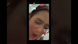 Keyshit blunder kelihatan utingnya pas live