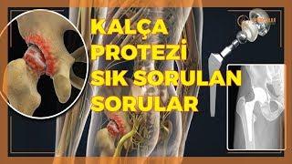 KALÇA PROTEZİ HAKKINDA SIK SORULAN SORULAR