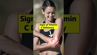 7 Common Signs of Vitamin C Deficiency