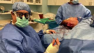 The Ocean Drive Facelift Surgery - Advanced Plastic Surgery | OceanDrivePlasticSurgery.com