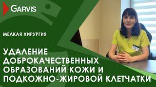 Удаление доброкачественных образований кожи и подкожно-жировой клетчатки в клинике Garvis