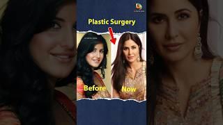 The Power of Plastic Surgery: Celebrities before vs after #facts #plasticsurgery #celebrity