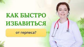 Как быстро избавиться от герпеса? Чем вылечить быстро герпес? Отвечает врач-иммунолог,кмн Ольга Брум