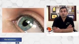 What is Keratoconus (करैटोकोनस)?  Dr. Karan Bhatia