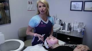 Facial mask treatment