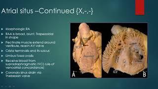 Segmental analysis of congenital heart defects