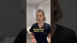 Высыпания вокруг рта! Причины.. #дерматолог #доктор #акне #кожа #косметика #угри #прыщи