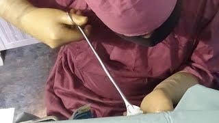 Gynecology ASMR, , ASMR Doctor, Gynecologist Surgeon, ASMR Cirujia ,( Surgery Gynecology Part 2)