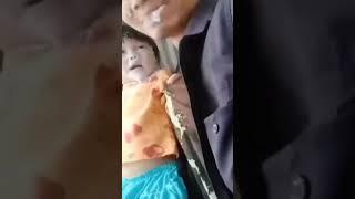 Crot Dimuka