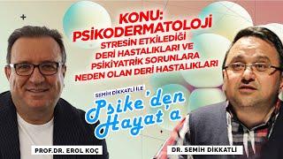 Psikodermatoloji | Konuk: Prof. Dr. Erol Koç | Semih Dikkatli ile "Psike'den Hayat'a"