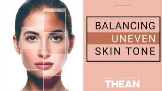 What Causes Uneven Skin Tone & How to Treat it Naturally?