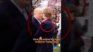 Have you noticed the bulge on Barron Trump's back?#shorts #usa #shortspay+ #trump #barrontrump