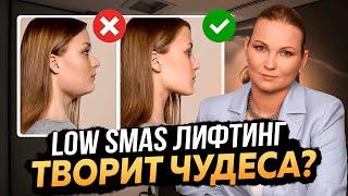 LOW SMAS ЛИФТИНГ - ВСЕ О МЕТОДИКЕ