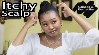 WHY IS MY SCALP ITCHY? | Itchy Scalp on Natural Hair | Tsholo Phoka