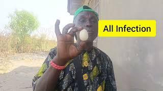 ALL BODY INFECTION