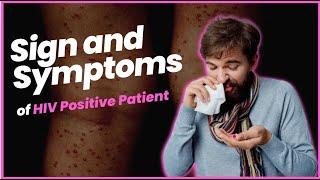 Sign and Symptoms of HIV Positive Patient