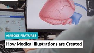 AMBOSS Features: How Medical Illustrations are Created