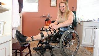 Woman Wants To Be Permanently Paralysed: Body Integrity Identity Disorder