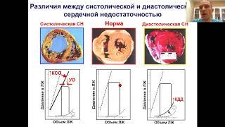 Патофизиология сердечной недостаточности