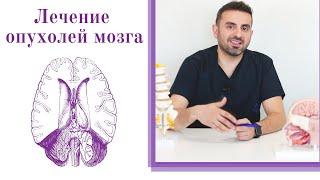 Опухоль головного мозга: симптомы, диагностика и современные методы лечения