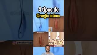 Cirurgia Íntima: Tem vontade de fazer?? #cirurgiaplastica #cirurgiaintima #ninfoplastia