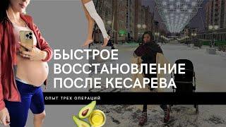 Быстрое восстановление после кесарева сечения. Третья операция - в чем разница?