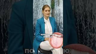 БЕЛЫЙ НАЛЕТ НА ЯЗЫКЕ