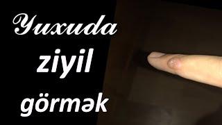 Yuxuda ziyil görmək  Qısa #yuxuyozma - SƏSLİ YUXU YOZMALARI