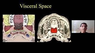 Head & Neck Spaces Made Simple, Dr. Suresh Mukherji, Medality (MRI Online) Radiology Noon Conference