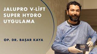 Jalupro V-Lift Super Hydro Uygulama - Op.Dr. Başar Kaya