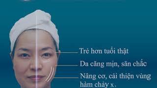 Năng Cơ Da Mặt Ultherapy - Công Nghệ Trẻ Hóa Da Không Phẫu Thuật Hàng Đầu Thế Giới