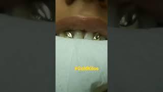 18k gold teeth how to make your gold grillz shine 