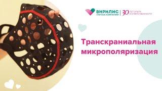 Транскраниальная микрополяризация