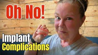 This Didn’t Go as Planned, Complications with All-on-Four Dental Implant Surgery