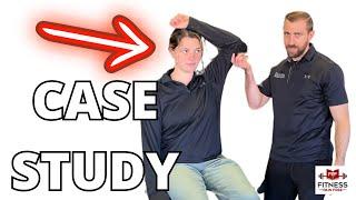 How I Diagnose and Treat Cervical Radiculopathy [CASE STUDY Physical Therapy]