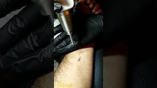 Tattoo remove| Parmanent Tattoo Remove| Laser Treatment|#viral #tattoo #ট্যাটু #laser #remove #ink