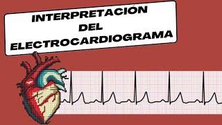 Interpreting the Electrocardiogram