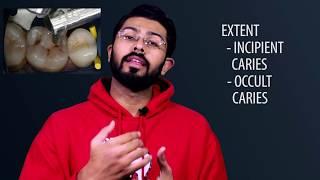 Various Classifications of Dental Caries