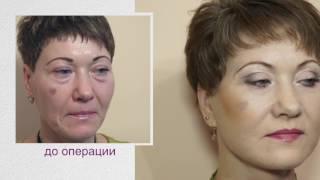 Пластическая операция на лице в Light Clinic