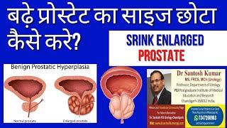 प्रोस्टेट को कैसे कम करें? Prostate size Reduction How ? .(Prof)Santosh Kumar PGI